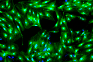 2D cell culture: stained with DAPI and Calcein AM (viability marker)