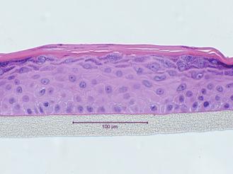 Epidermal 3-D Tissue Construct Histology
