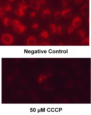 Figure MitoTox Pics control vs CCCP